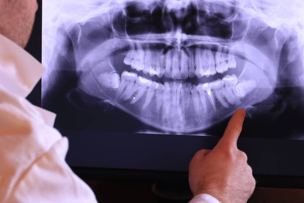 Best Emergency Root Canal Therapy in Flint Hill, MO
